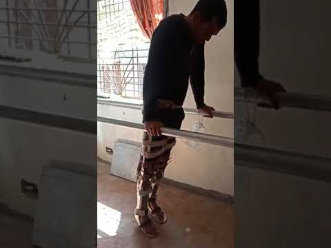 Caliper and Orthotic Supports Gait Video