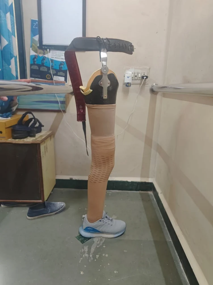 Above Knee Thumb 3