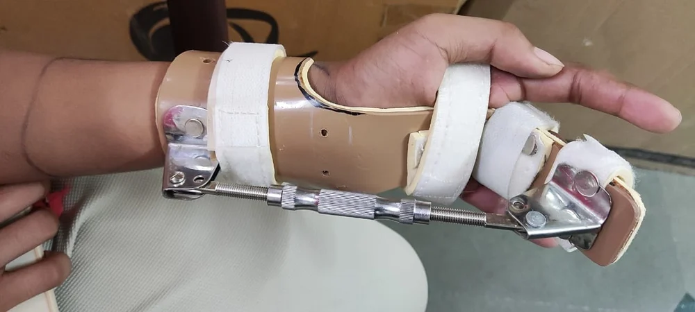 Splint 2