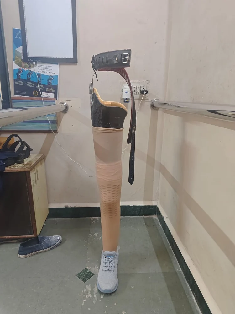 Above Knee Thumb 1