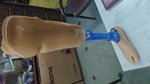 Titanium Alloy Surgical Bone Prosthesis – Singar Rehab