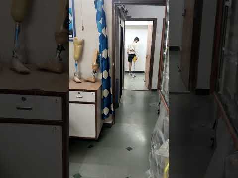 Artificial Prosthetic Leg Demonstration - Singar Rehab