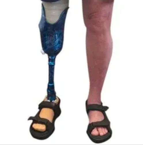 Artificial Right Knee Prosthesis – Singar Rehab