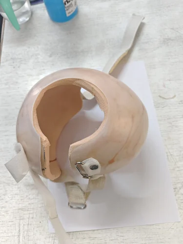 Plastic Foam Helmet Cranial – Pediatric Cranial Remodeling Helmet Singar Rehab