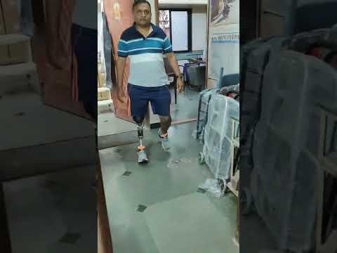 Above Knee Prosthetic Limb Video - Singar Rehab