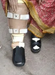 Fixed Ankle Brace Orthosis - Posterior Splint